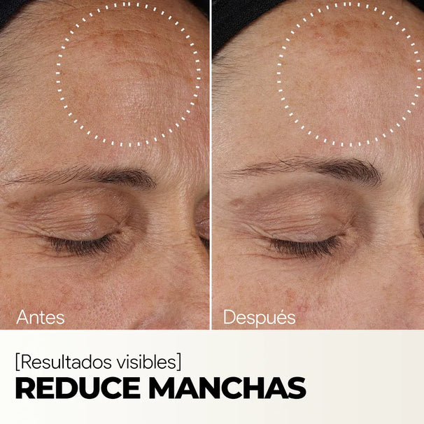 Tu piel más firme y radiante comienza aquí